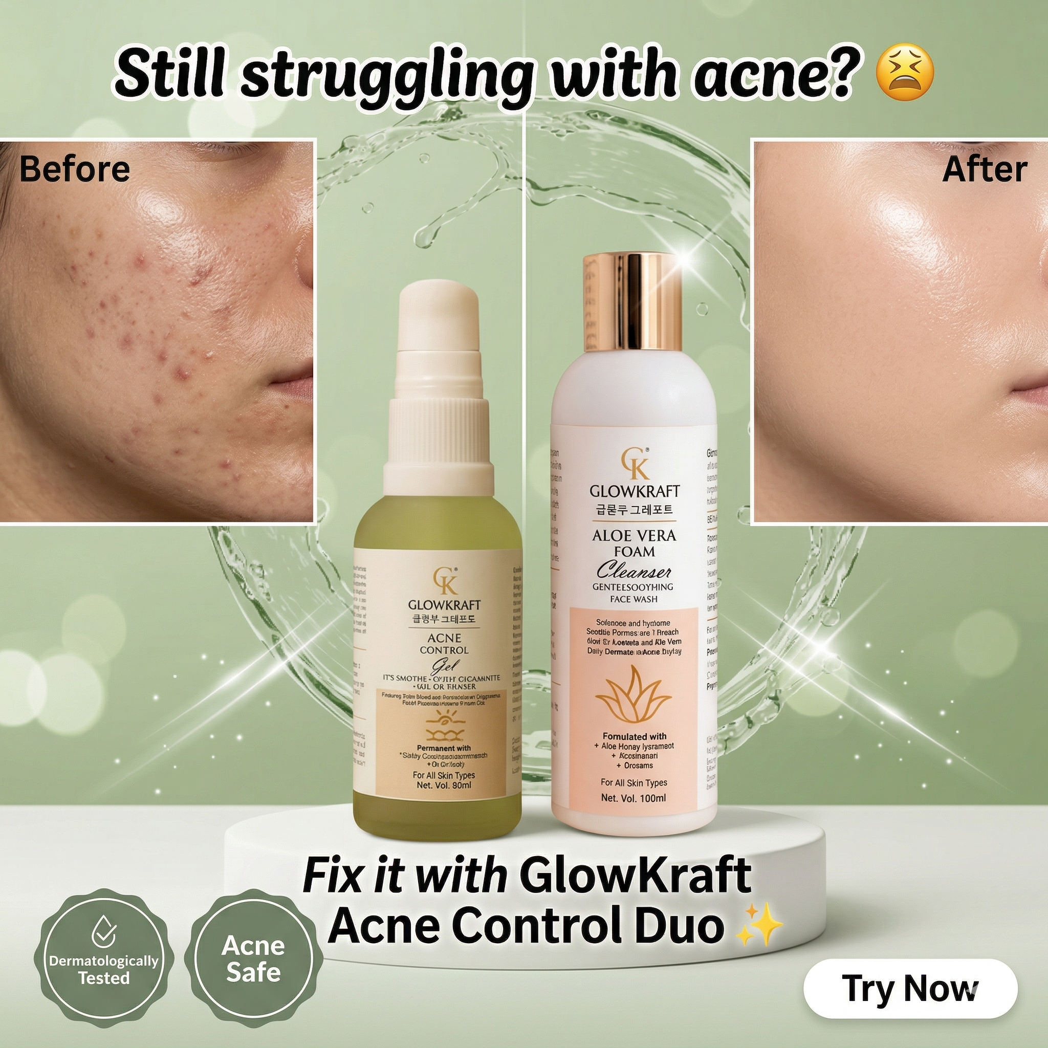 GlowKraft Acne Control Duo | Acne Control Gel 30 ml + Aloe Vera Cleanser for Oily & Acne-Prone Skin 100 ml