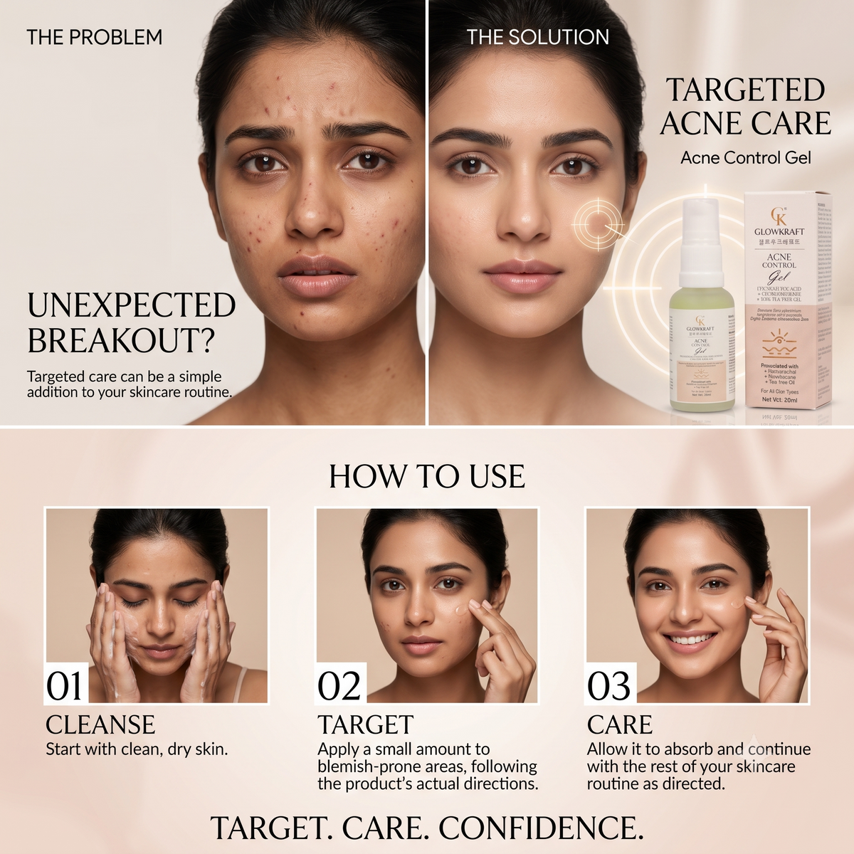 Acne Control Gel  Anti-Blemish Treatment